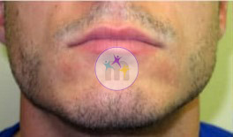 beard 1 1
