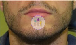 beard 1 2