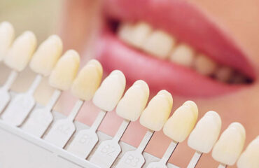 dental match