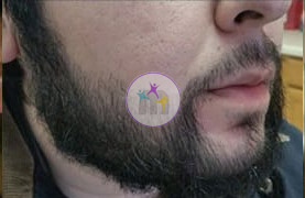 beard 3 2