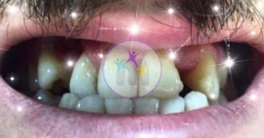 dental implant 7 1 dental implant 7 1