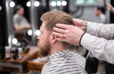 How long does a hair transplant last